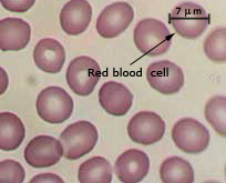 Normal blood cells